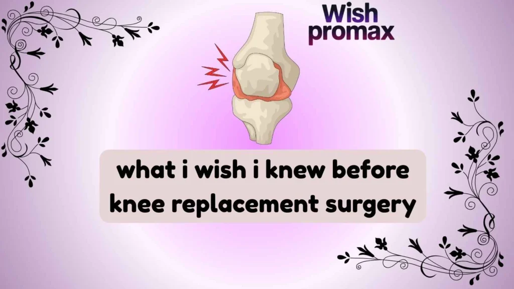 what i wish i knew before knee replacement surgery